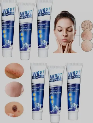Warts Remover Ointment
